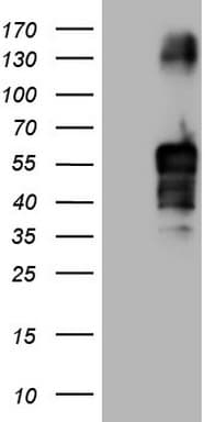 Monoclonal Mouse anti-Human FBLIM1 / Migfilin Antibody (clone OTI3F8, aa1-242, WB)