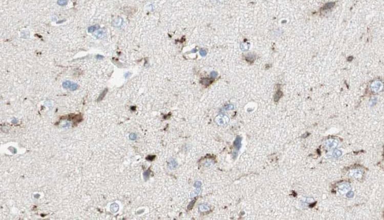 WASF3 Antibody