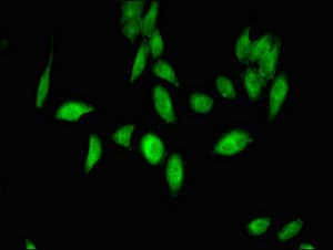 E6AP / UBE3A Antibody
