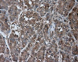 Monoclonal Mouse anti-Human NME4 Antibody (clone OTI1H1, IHC, IF, WB)