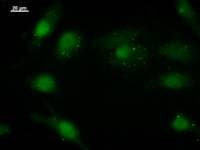 Monoclonal Mouse anti-Human EIF4ENIF1 / 4E-T Antibody (clone 2314C3a, IF, WB)