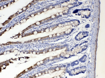 CYP2D6 Antibody