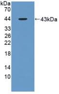 Aspartate Aminotransferase Antibody (aa1-413)