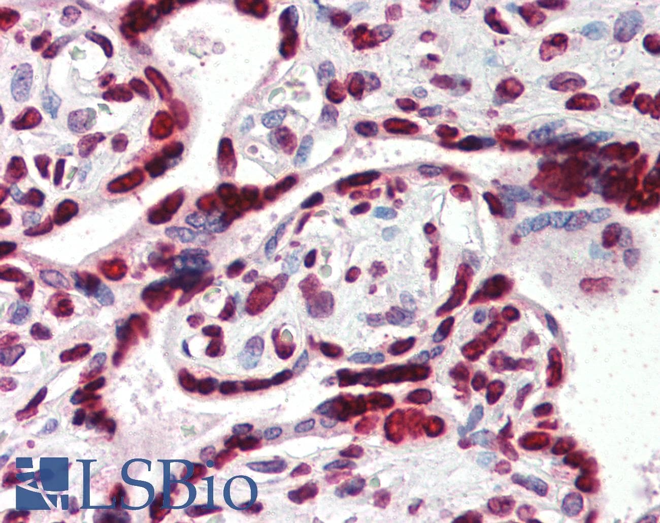 IHC-plus™ HMGIY / HMGA1 Antibody (aa12-23)