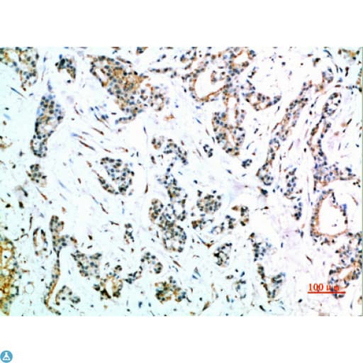 FCGR1A / CD64 Antibody