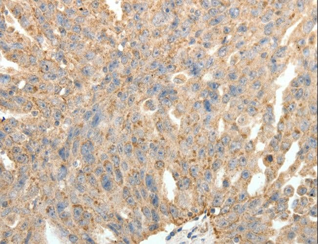 Polyclonal Rabbit anti-Human SYT11 Antibody (IHC)