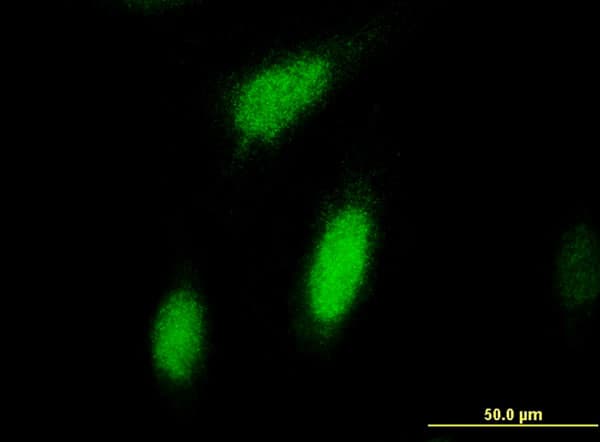 RPS6KA3 / RSK2 Antibody (clone 2G10)