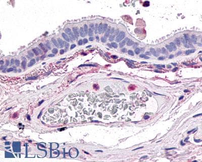 PathPlus™ Polyclonal Rabbit anti-Human GPR4 Antibody (Extracellular Domain, IHC)