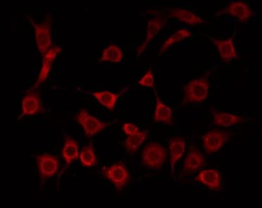 Polyclonal Rabbit anti-Human LDLRAD1 Antibody (IF, WB)