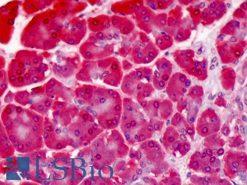 IHC-plus™ HSPA8 / HSC70 Antibody (clone 1B5)