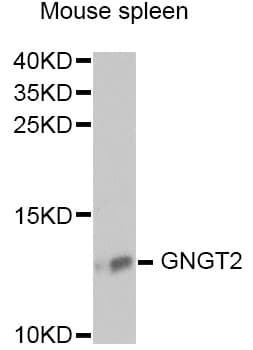 Polyclonal Rabbit anti-Human GNGT2 Antibody (WB)