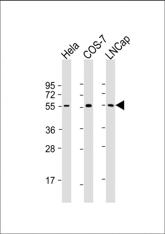 SUFU Antibody (clone 1783CT536.263.29)