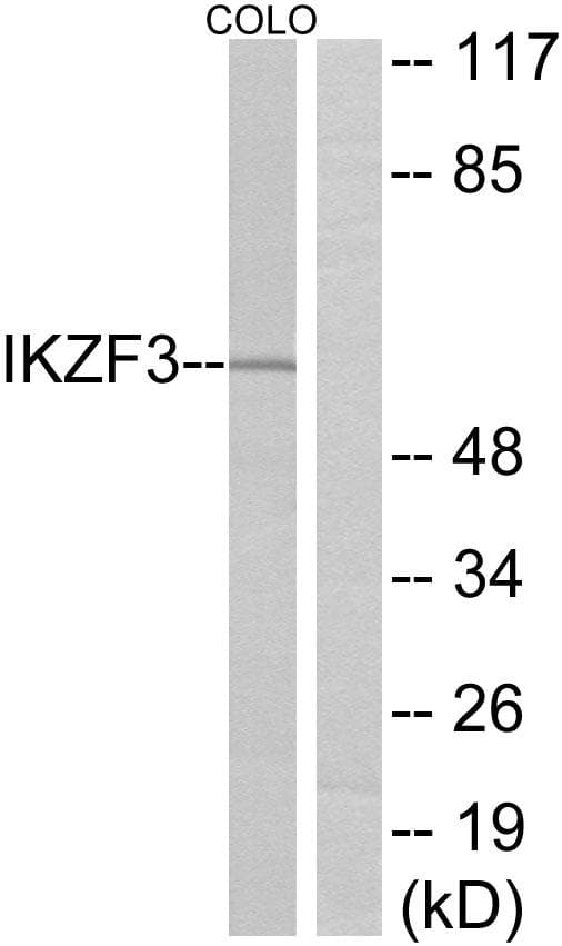 Polyclonal Rabbit anti-Human IKZF3 / AIOLOS Antibody (WB)