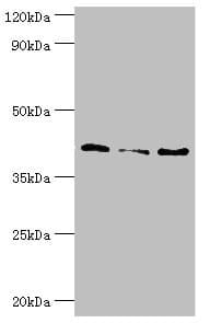 SERPINB5 / Maspin Antibody (aa21-189)