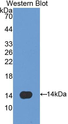 CAV1 / Caveolin 1 Antibody (aa2-105, Cy3)
