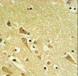 PAAF1 Antibody (aa109-138)