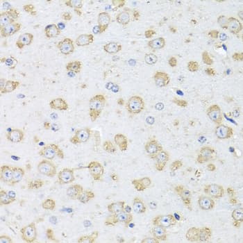ALB / Serum Albumin Antibody