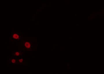Polyclonal Rabbit anti-Human BUD31 Antibody (IF, WB)