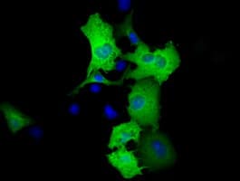 Monoclonal Mouse anti-Human RIP1 / RALBP1 Antibody (clone OTI11C6, IF, WB)