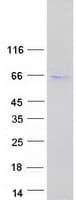 Human PNPLA2 / ATGL Protein (Recombinant Myc-DDK (Flag))