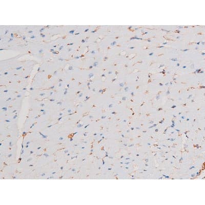 STAT1 Antibody (phospho-Ser727)