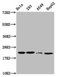 Polyclonal Rabbit anti-Human HIST1H1E Antibody (WB)