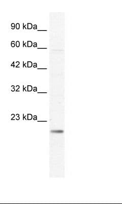 KCNIP2 / KCHIP2 Antibody (aa40-89)