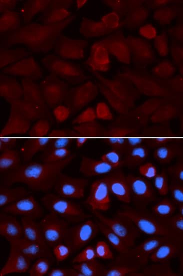 Polyclonal Rabbit anti-Human ALDH3A1 Antibody (IHC, IF, WB)
