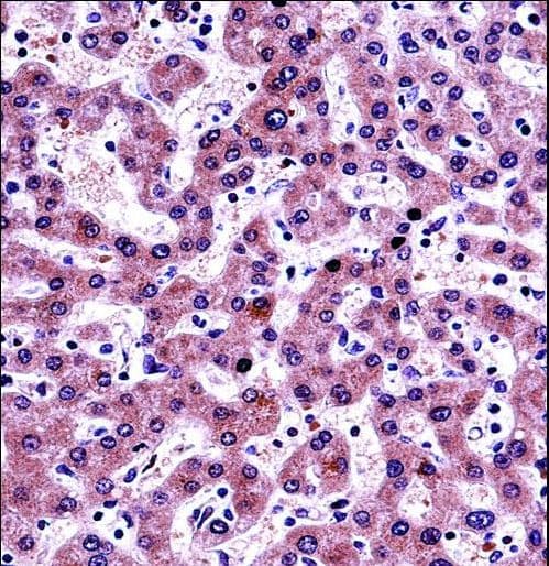 Polyclonal Rabbit anti-Human NNMT Antibody (aa101-130, IHC, WB)