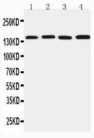 TJP2 / ZO2 / ZO-2 Antibody (aa1149-1167)
