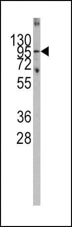 PARG Antibody (aa390-421)