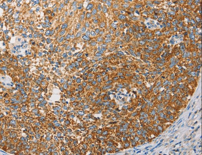 Polyclonal Rabbit anti-Human APOBEC3G / CEM15 Antibody (IHC)