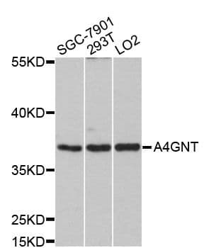 Alpha4GnT / A4GNT Antibody