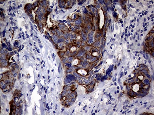 KRT18 / CK18 / Cytokeratin 18 Antibody (aa69-372, clone OTI10G8)