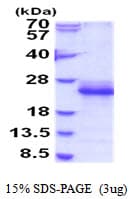 Mouse IL-33 Protein (Recombinant His)