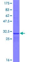 Human CerS6 / LASS6 Protein (Recombinant GST)