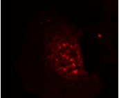 AKT1 Antibody