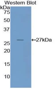NNMT Antibody (aa1-264, Biotin)