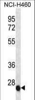 IL6 / Interleukin 6 Antibody (aa27-55)