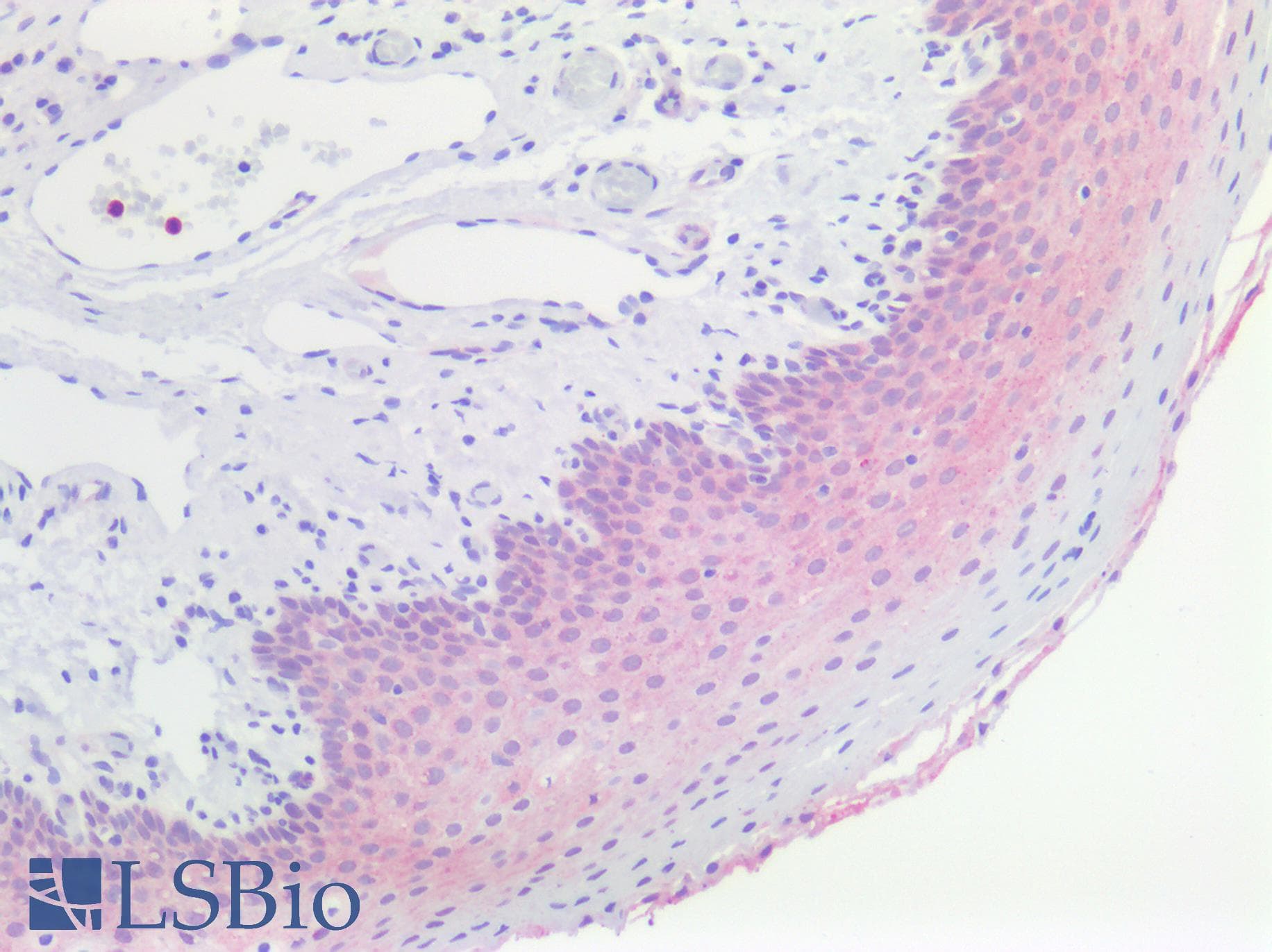 IHC-plus™ Polyclonal Rabbit anti-Human PVRL4 / Nectin 4 Antibody (aa371-510, IHC, WB)