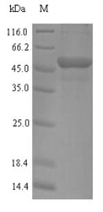 Human MYBPC2 Protein (Recombinant 6His, N-terminus)