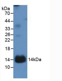 Human IL1R1 Protein (Recombinant His, N-Terminal)