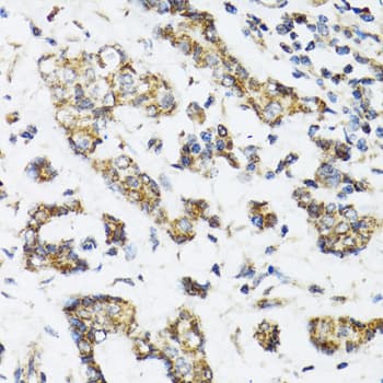 DHRS2 / HEP27 Antibody