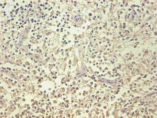 LCN2 / Lipocalin 2 / NGAL Antibody