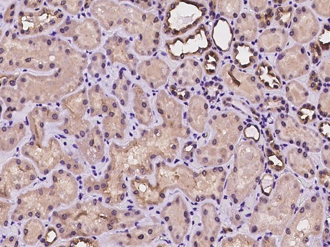 BAD Antibody