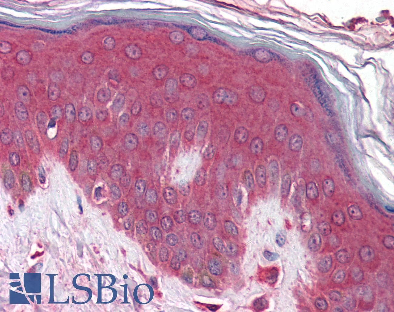 Polyclonal Rabbit anti-Human KLHL23 Antibody (aa432-481, IHC, WB)