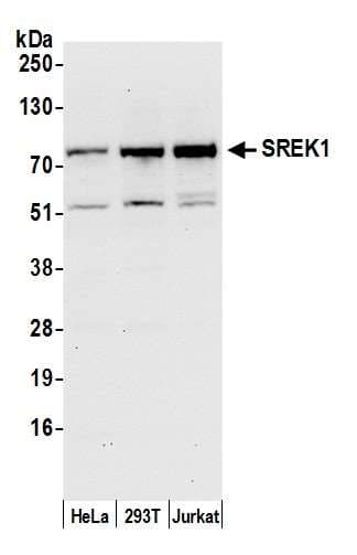 Polyclonal Rabbit anti-Human SREK1 / SRRP86 Antibody (aa458-508, WB)