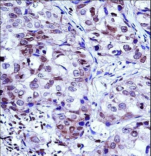 HIST1H1D Antibody (aa135-164)