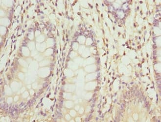 ZNF544 Antibody