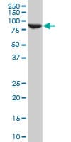 IHC-plus™ STAT5B Antibody (clone 2D1)